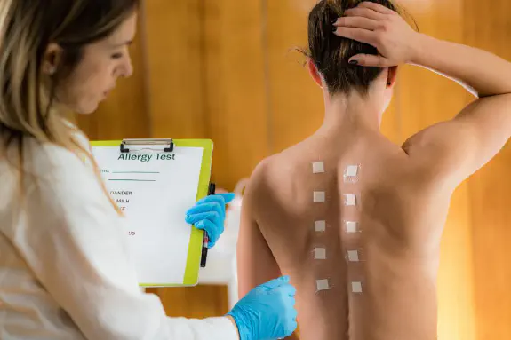 Wij kunnen testen aan de hand van allergie klachten